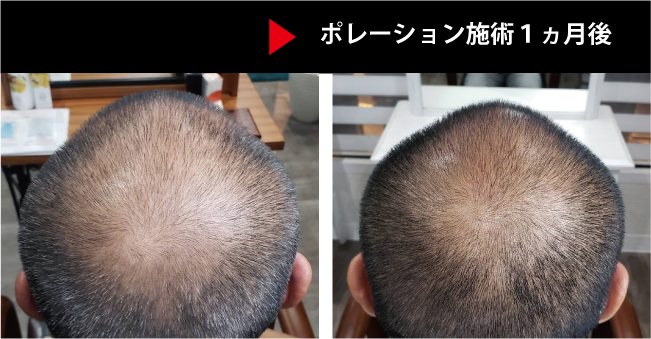 育毛メンズ 育毛メンズ