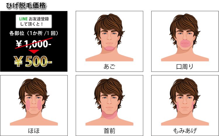 メンズエステ脱毛